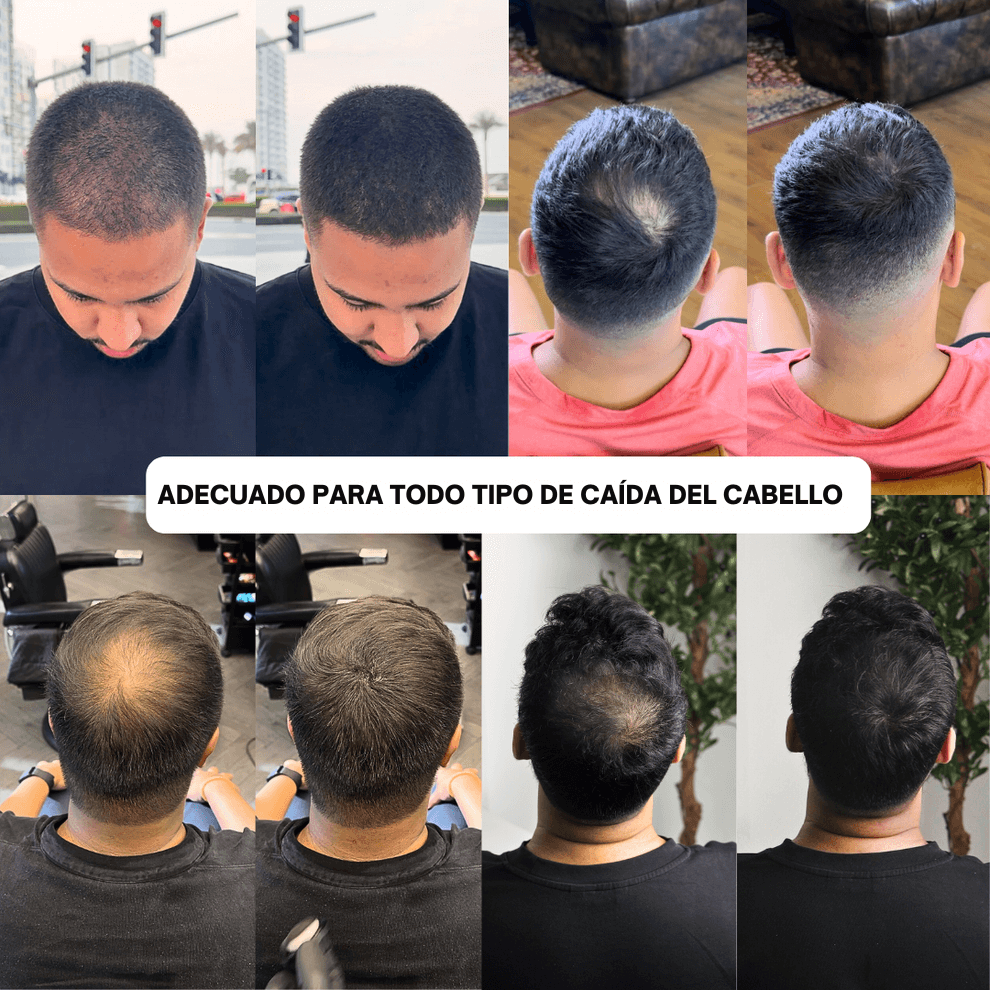 HairPic™ Polvos para cubrir el cabello