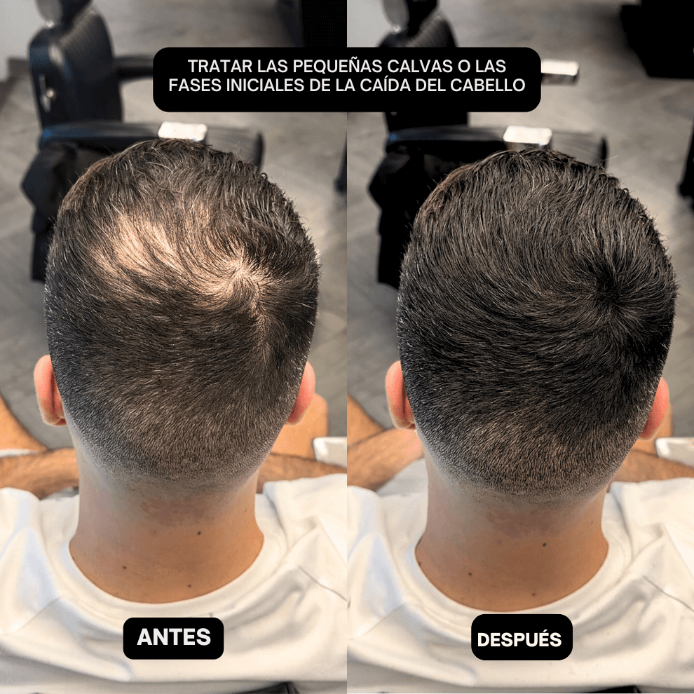 HairPic™ Polvos para cubrir el cabello