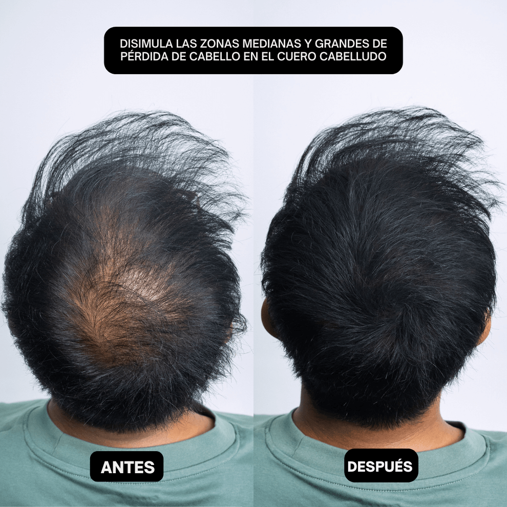 HairPic™ Polvos para cubrir el cabello