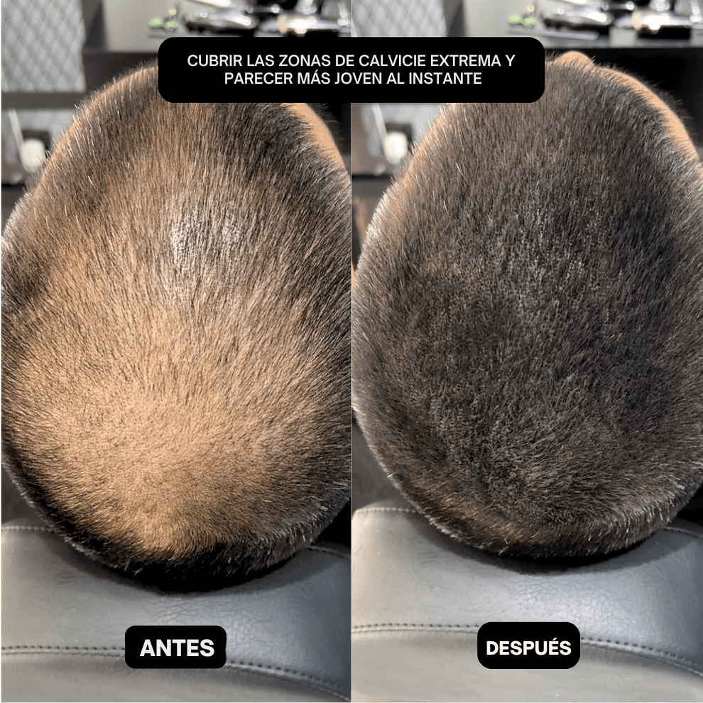 HairPic™ Polvos para cubrir el cabello