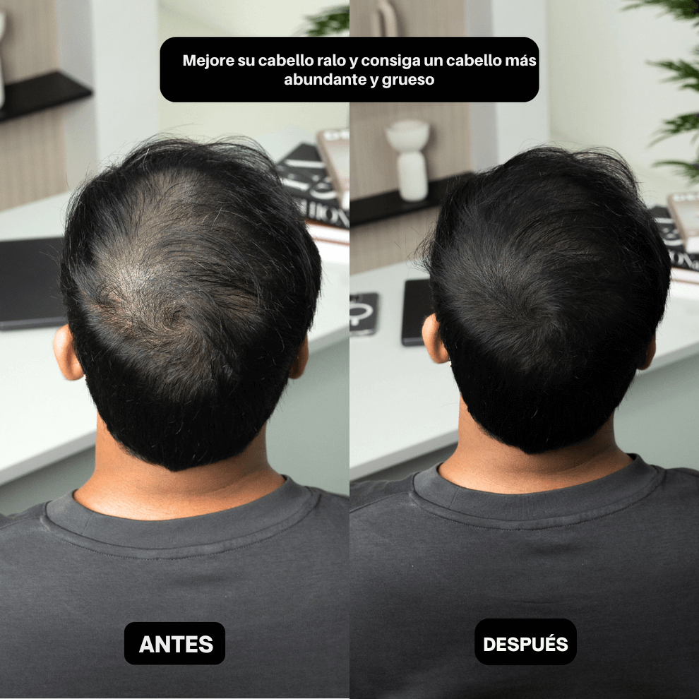 HairPic™ Polvos para cubrir el cabello