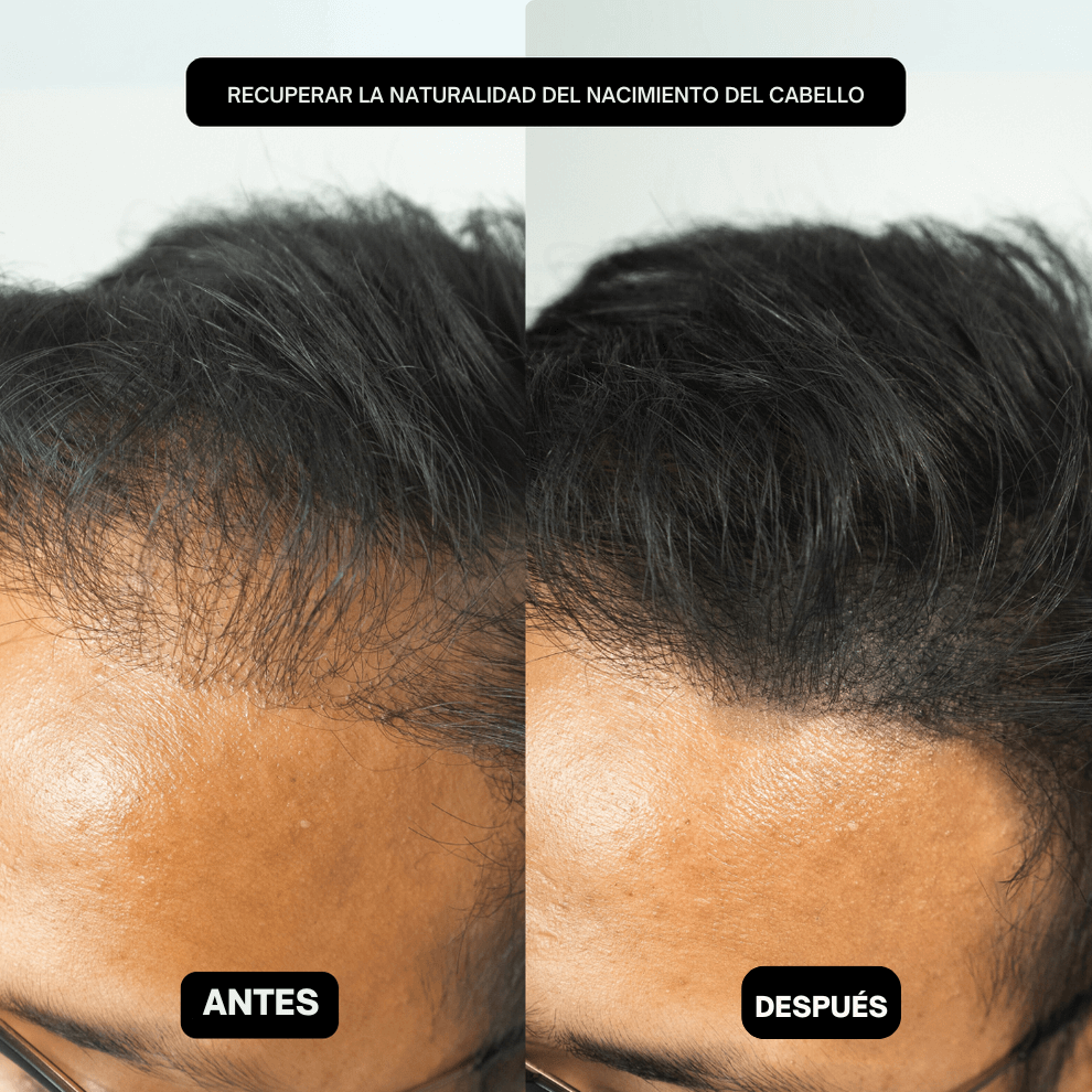 HairPic™ Polvos para cubrir el cabello