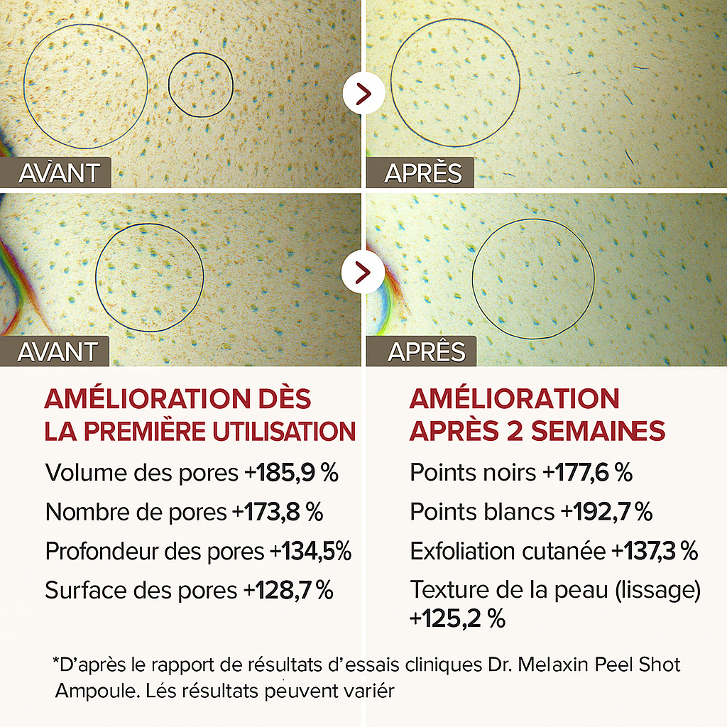 Kit Exfoliant Complet – Résultats visibles dès 7 jours
