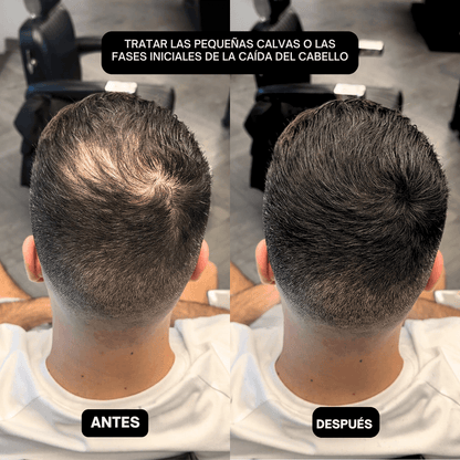 HairPic™ Polvos para cubrir el cabello