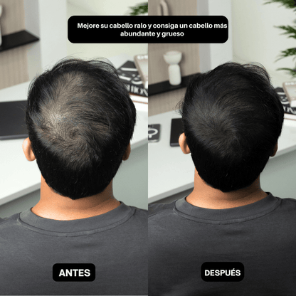 HairPic™ Polvos para cubrir el cabello