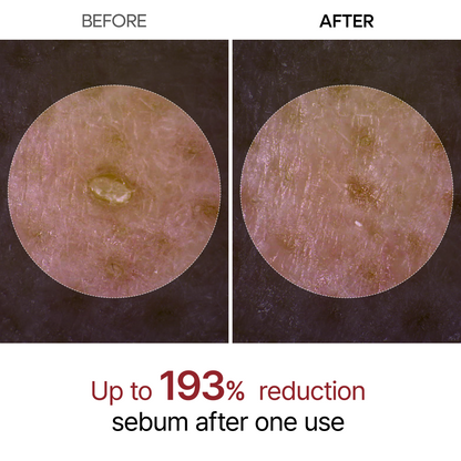 Sérum de riz blanc - Exfoliant naturel
