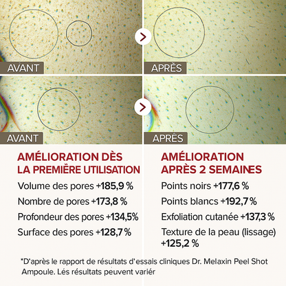 Kit Exfoliant Complet – Résultats visibles dès 7 jours