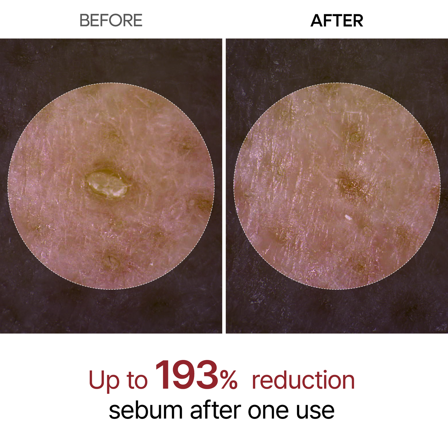 Sérum de riz noir -  Exfoliant naturel